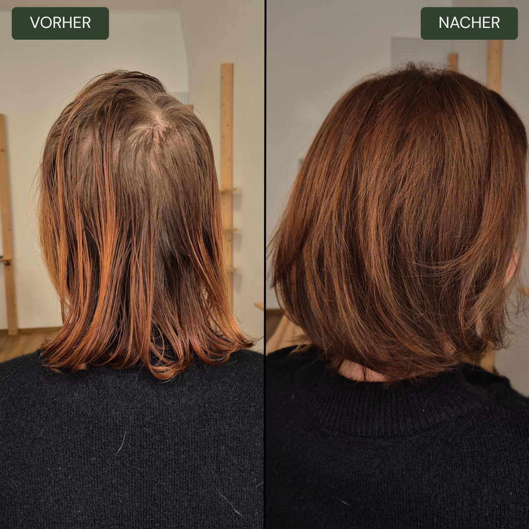 Vorher Nacher Foto